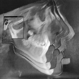 FMA Orthodontic Diagnostic & Treatments